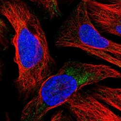 ATRNL1 Antibody, Novus Biologicals:Antibodies:Primary Antibodies
